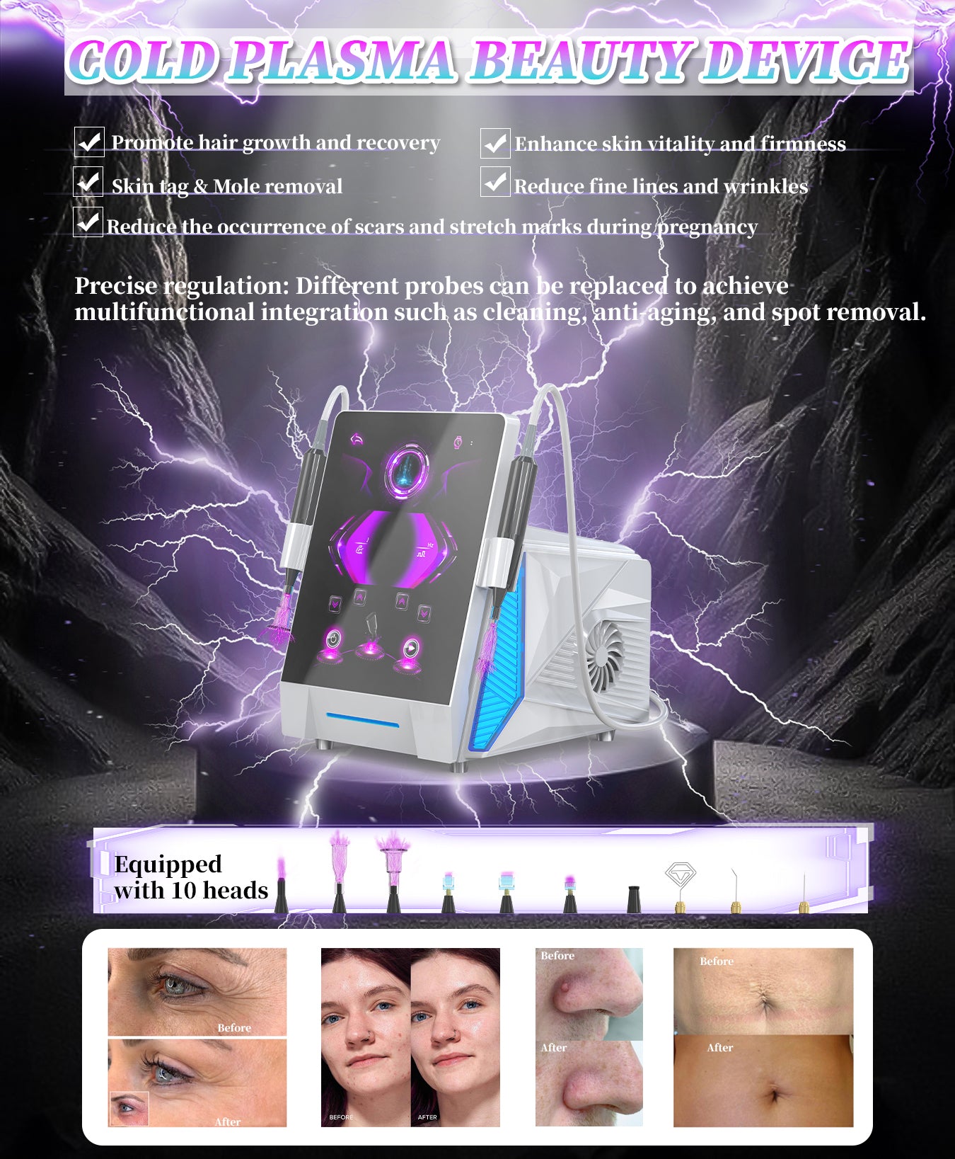 Ultimate Pro Aesthetic Cold Plasma - 10 Handles
